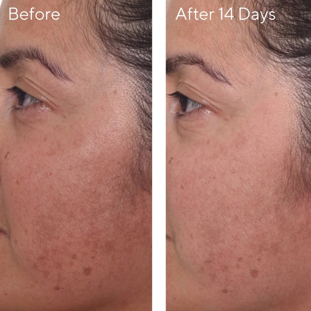 Murad Mini Rapid Dark Spot Correcting Serum - Picture 2 of 2